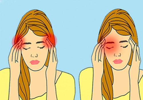 7 Types of Headaches: Causes, Symptoms, and Treatments
