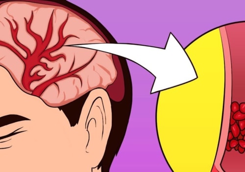 How to Quickly Relieve Tension Headaches